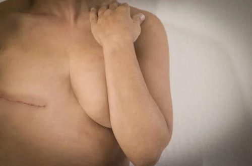 Breast Surgeon New York Advanced Procedures and Compassionate Care